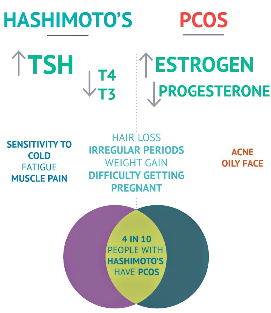 hypothyroidism hashimotos and pcos
