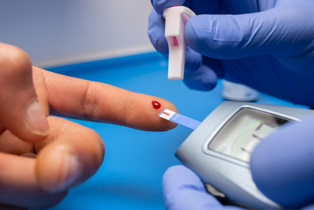 what is the best time for hba1c test?